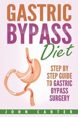 Gastric Bypass Diet: Step By Step Guide to Gastric Bypass Surgery by Carter, John