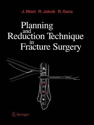 Planning and Reduction Technique in Fracture Surgery by Willenegger, H.