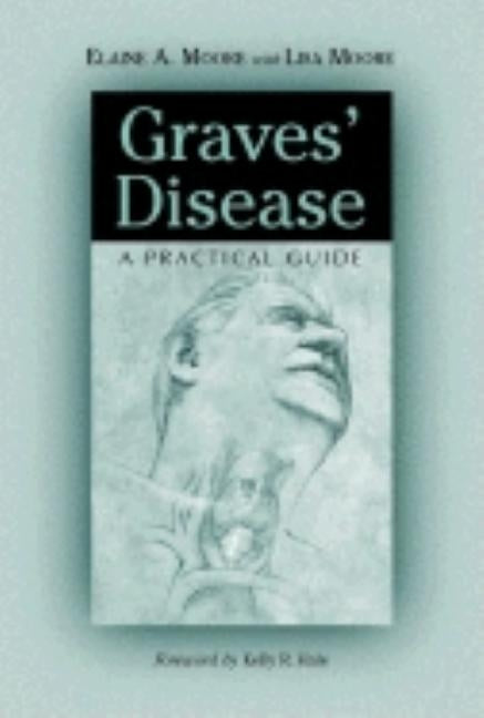 Graves' Disease: A Practical Guide by Moore, Elaine A.