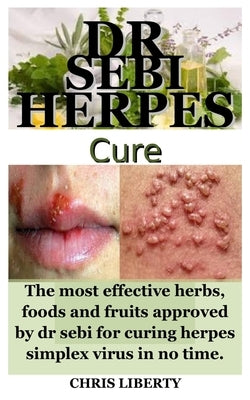 Dr Sebi Herpes Cure: The most effective herbs, foods and fruits approved by dr sebi for curing herpes simplex virus in no time. by Liberty, Chris