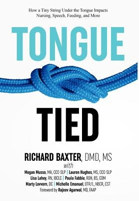 Tongue-Tied: How a Tiny String Under the Tongue Impacts Nursing, Speech, Feeding, and More by Baxter, DMD Richard