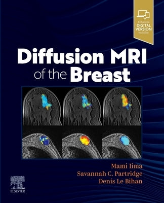 Diffusion MRI of the Breast by Iima, Mami