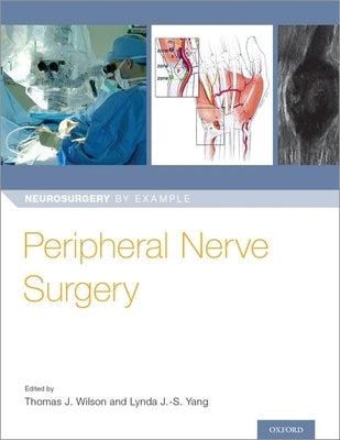 Peripheral Nerve Surgery by Wilson, Thomas