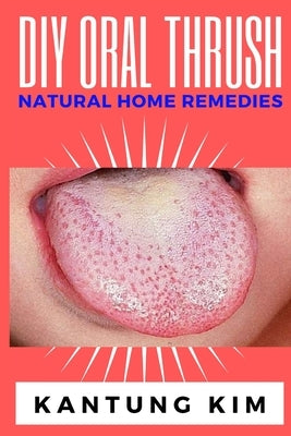 DIY Oral Thrush Natural Home Remedies: The Effective Step By Step Guide To Permanently End Oral Thrush by Kim, Kantung