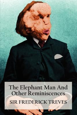 The Elephant Man and Other Reminiscences by Treves, Frederick