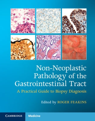 Non-Neoplastic Pathology of the Gastrointestinal Tract with Online Resource: A Practical Guide to Biopsy Diagnosis [With Access Code] by Feakins, Roger M.