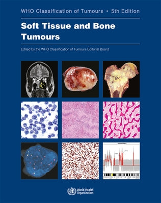 Soft Tissue and Bone Tumours: Who Classification of Tumours by Who Classification of Tumours Editorial