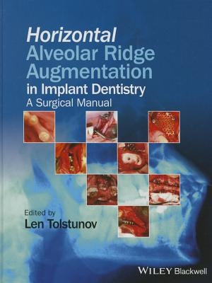 Horizontal Alveolar Ridge Augmentation in Implant Dentistry: A Surgical Manual by Tolstunov, Len