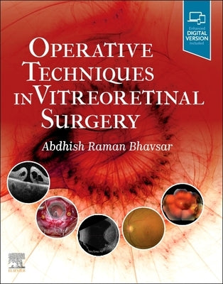 Operative Techniques in Vitreoretinal Surgery by Bhavsar, Abdhish R.