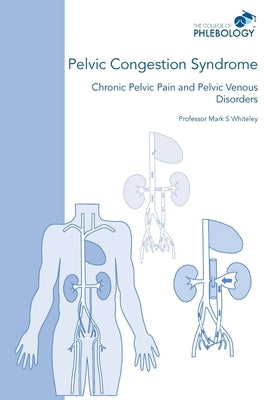 Pelvic Congestion Syndrome - Chronic Pelvic Pain and Pelvic Venous Disorders by Whiteley, Mark S.