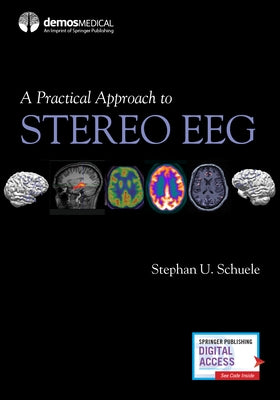 A Practical Approach to Stereo Eeg by Schuele, Stephan