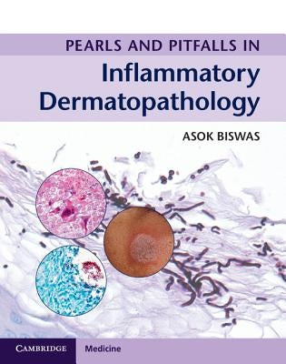 Pearls and Pitfalls in Inflammatory Dermatopathology by Biswas, Asok