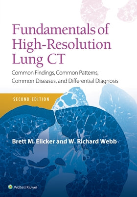 Fundamentals of High-Resolution Lung CT: Common Findings, Common Patterns, Common Diseases and Differential Diagnosis by Elicker, Brett M.