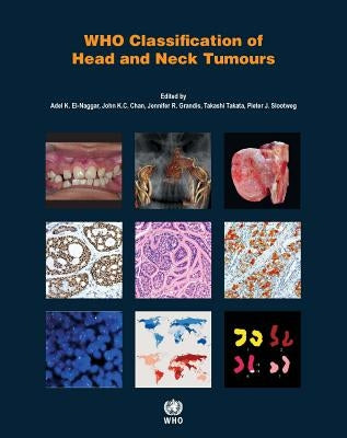 WHO Classification of Head and Neck Tumours by Who Classification of Tumours Editorial