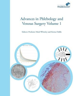 Advances in Phlebology and Venous Surgery Volume 1 by Whiteley, Mark S.