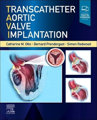 Transcatheter Aortic Valve Implantation by Otto, Catherine M.