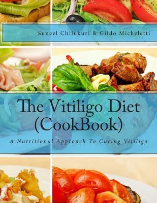 The Vitiligo Diet (CookBook): A Nutritional Approach To Curing Vitiligo by Micheletti, Gildo