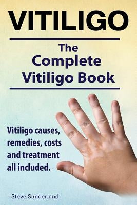Vitiligo. Vitiligo causes, remedies, costs and treatment all included. The complete Vitiligo Book. by Sunderland, Steve
