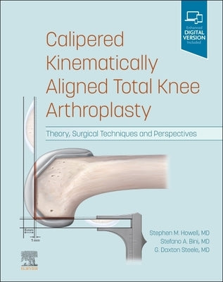 Calipered Kinematically Aligned Total Knee Arthroplasty: Theory, Surgical Techniques and Perspectives by Howell, Stephen M.