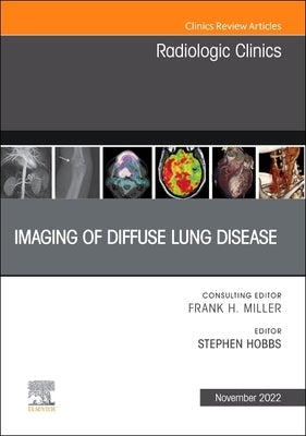 Imaging of Diffuse Lung Disease, an Issue of Radiologic Clinics of North America: Volume 60-6 by Hobbs, Stephen
