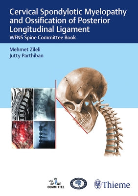 Cervical Spondylotic Myelopathy and Ossification of Posterior Longitudinal Ligament: Wfns Spine Committee Book by Zileli, Mehmet