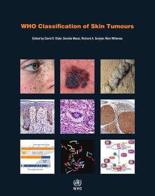 Who Classification of Skin Tumours by Who Classification of Tumours Editorial