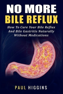 No More Bile Reflux: How to Cure Your Bile Reflux and Bile Gastritis Naturally Without Medications by Higgins, Paul