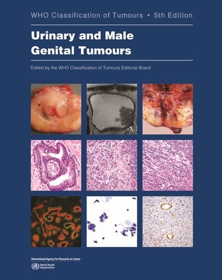 Urinary and Male Genital Tumours by Who Classification of Tumours Editorial